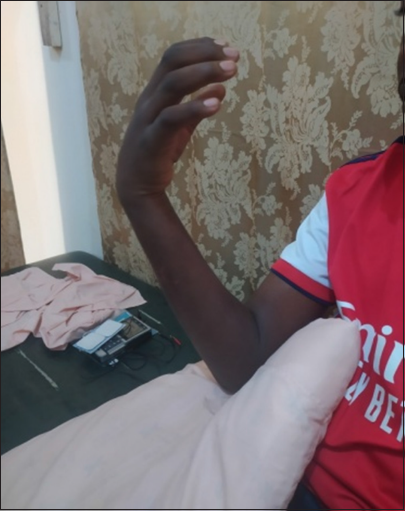 Elbow flexion against gravity after few sessions.