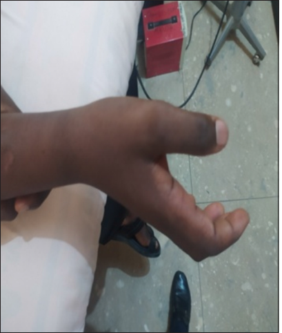 Attempt wrist joint antigravity movement in flexion or extension.