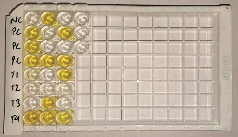 Enzyme-linked immunosorbent assay microtiter plate displaying NC as the negative control, PC as the positive control run in triplicate and test samples T1 to T23. Color development occurs after the addition of the stop solution. (1) NC <0.150 was considered valid, (2) PC more than 0.500 was considered valid, (3) if neither was true, the run was considered invalid, (4) cutoff absorbance = PCx × 0.23, (5) for example, if PCx = 1.87, the cutoff value would be 1.87 × 0.23 = 0.430, (6) test absorbance value <0.430 is considered negative, and (7) test absorbance value of ≥0.430 is considered positive.